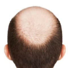 james_bald