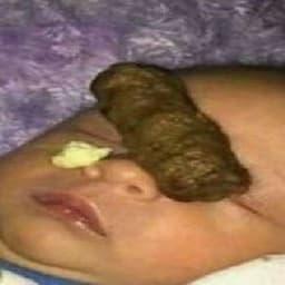 nocandopapi