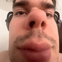 germma
