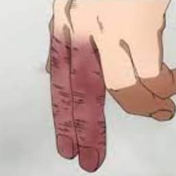 Fingerlugt3n