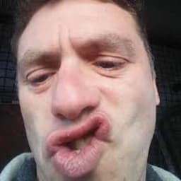 brnloko