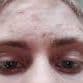 bald_llama