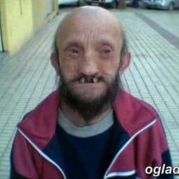 lolpadekx