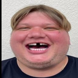 N0On3SS