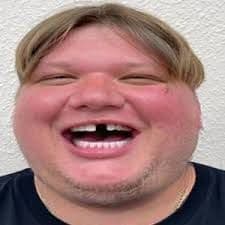 Lukkiz1