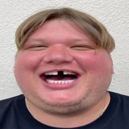 pidarimple