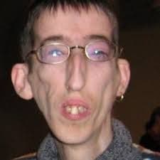 Moe_Mini