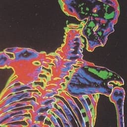 vloneflex